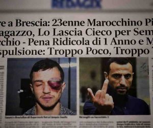 Marocchino Picchia un Ragazzo, Lo Lascia Cieco per Sempre a un Occhio