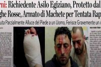 Africano col machete amputa pezzo di piede ad un uomo per strada