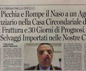 Africano Rompe il Naso ad Agente: Frattura e 30 Giorni di Prognosi