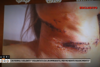 Torturata e stuprata da immigrato che voleva farla a pezzi