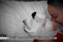 Ragazzino italiano massacrato da tunisini: occhio distrutto e ridono di lui