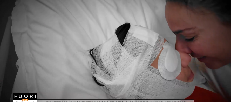 Ragazzino italiano massacrato da tunisini: occhio distrutto e ridono di lui