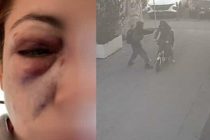 Pesta a sangue mamma che porta bimbo dal dottore: già libero