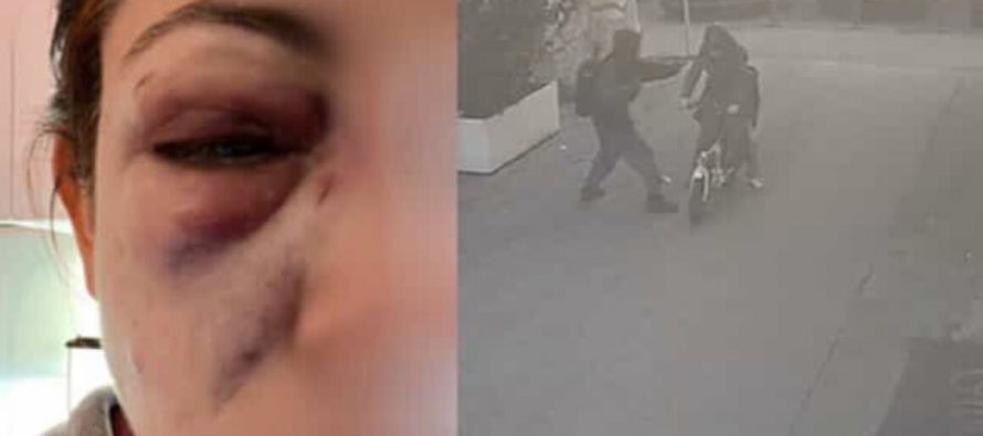 Pesta a sangue mamma che porta bimbo dal dottore: già libero