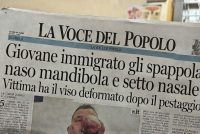 Distrugge la faccia a italiano di 55 anni ma è ai domiciliari