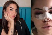 Ridotta così da un immigrato: ora sta con un italiano