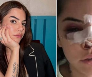 Ridotta così da un immigrato: ora sta con un italiano