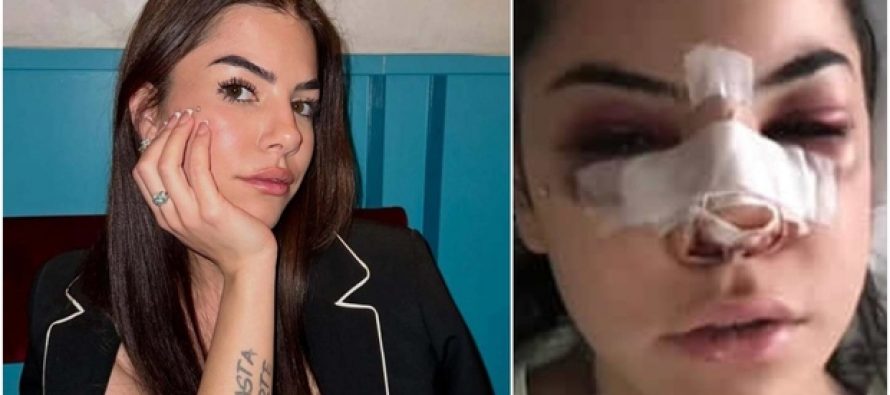 Ridotta così da un immigrato: ora sta con un italiano