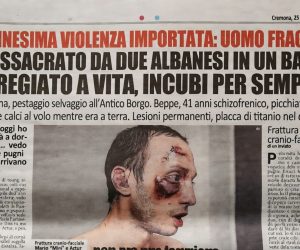 Due immigrati lo hanno sfigurato e ha quasi perso la vista